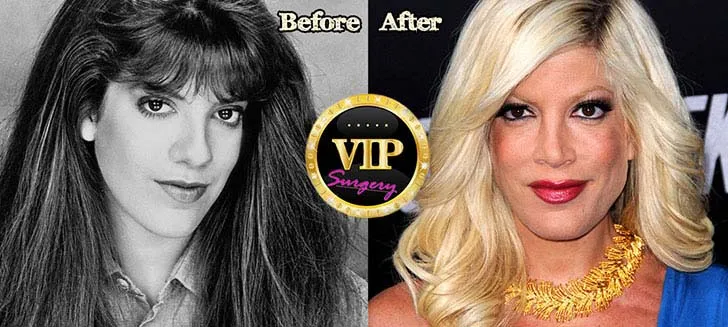 30 celebrites au physique ravage 11