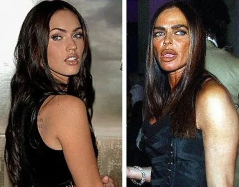 20 celebrites au physique ravage par la chirurgie esthetique
