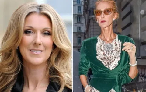 apres sa perte de poids celine dion confirme ce que nous savions depuis le debut
