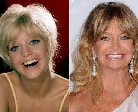Ou en sont ces magnifiques 80