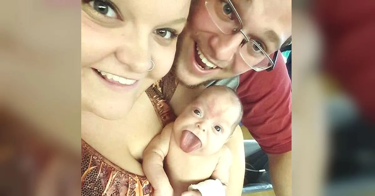 Un bébé né avec une langue de la taille de celle d’un adulte sourit pour la première fois après une intervention chirurgicale.